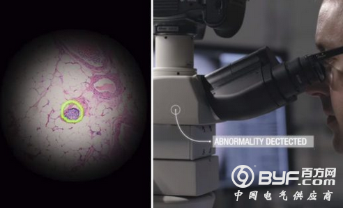 谷歌推出AR显微镜 可利用机器学习技术迅速发现癌细胞