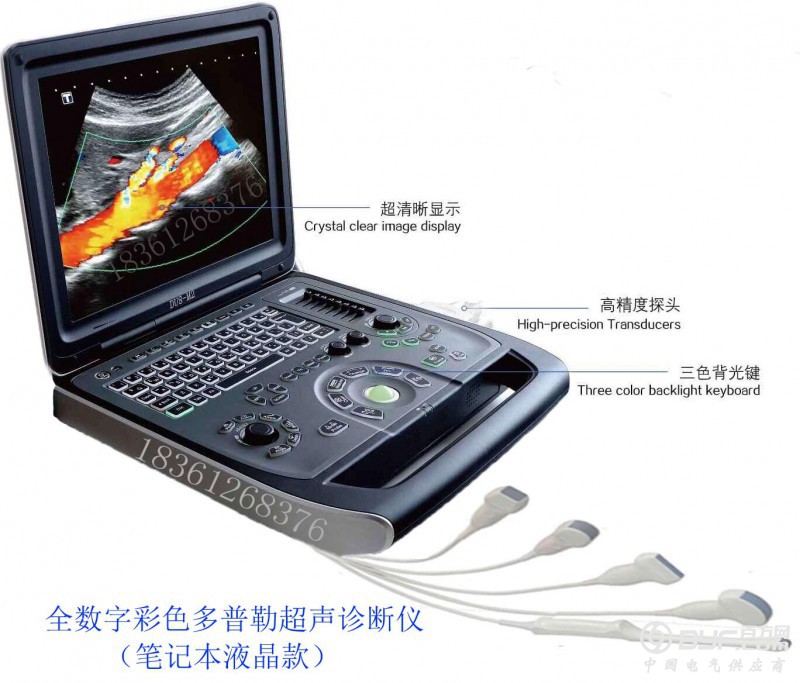 全数字彩超(笔记本款)