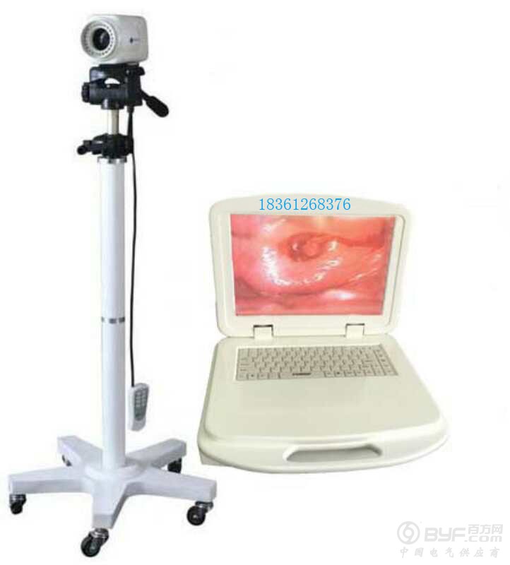 数字彩色高清数码电子阴道镜(笔记本)