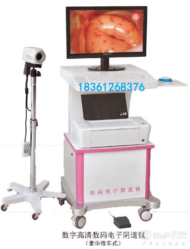 数字高清数码电子阴道镜单屏