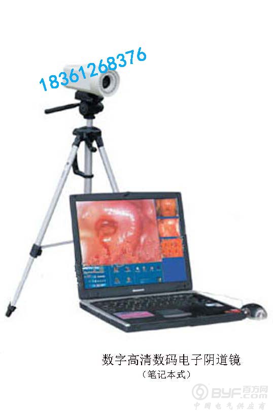 数字高清数码电子阴道镜（笔记本式）