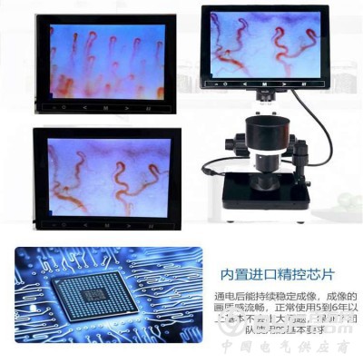 微循环检测仪奥斯康厂家招商图2