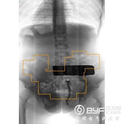 启路达微剂量腹部安检机器人图2
