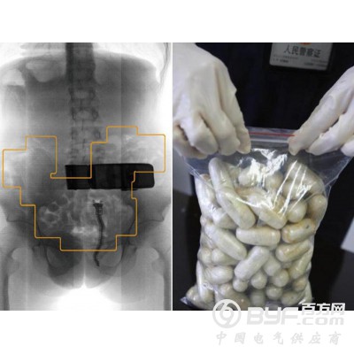 启路达微剂量腹部安检机器人图3